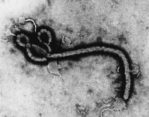 Electron micrograph image of the Ebola virus.